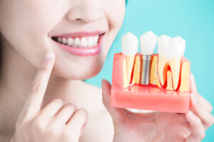 Woman Holding Dental Model